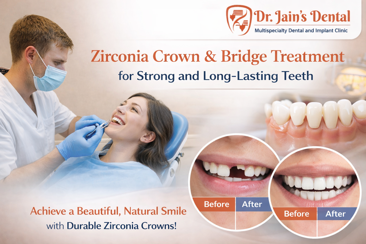 Zirconia Crown & Bridge Treatment for Strong and Long-Lasting Teeth